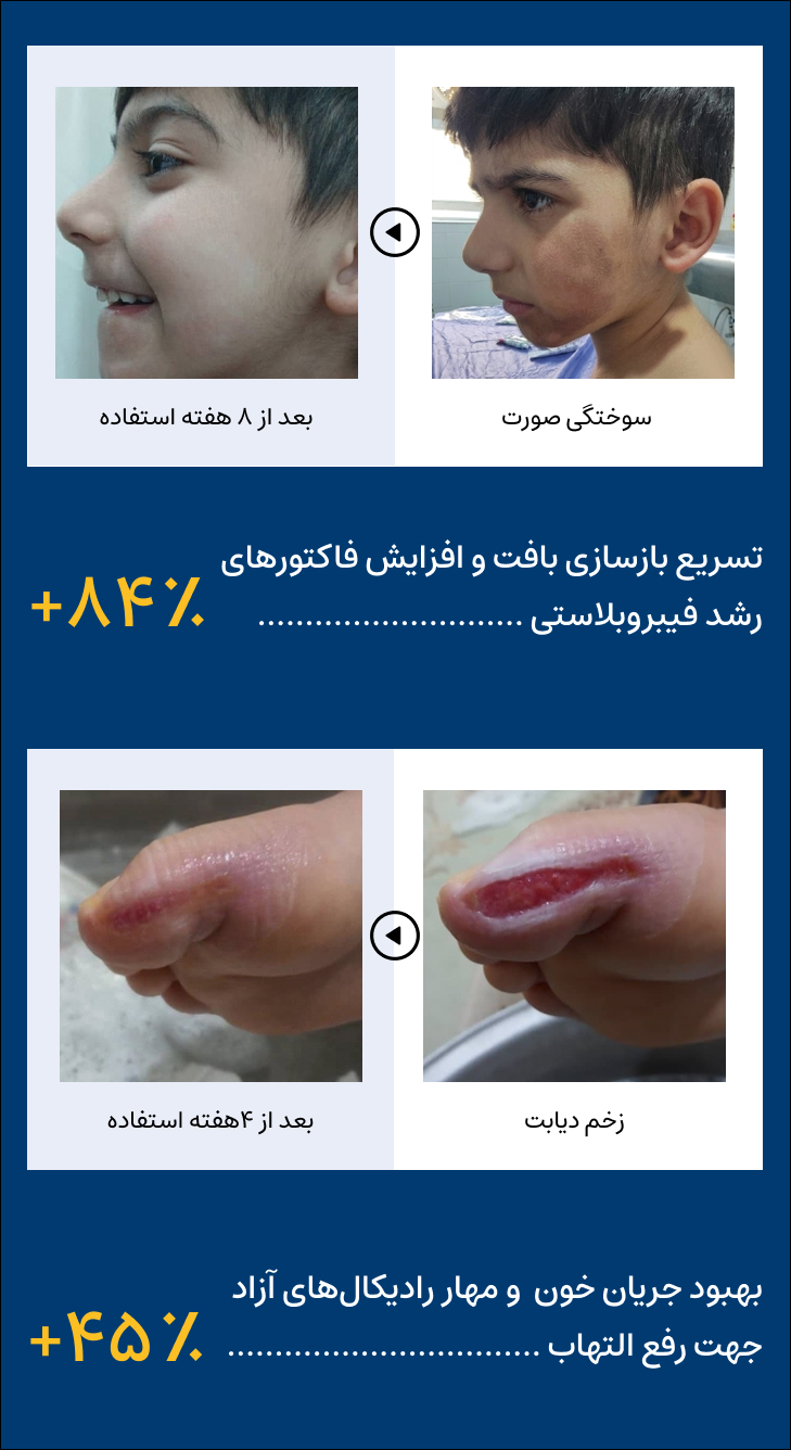 قبل و بعد از استفاده